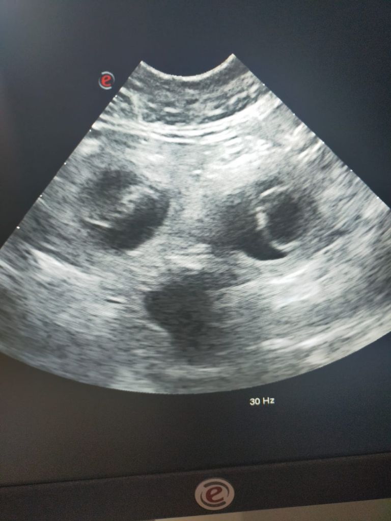 Dorky - Pregnancy is confirmed